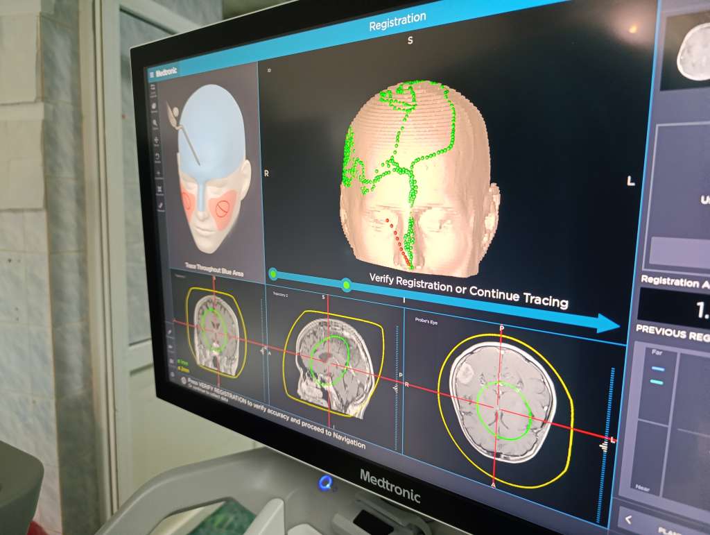 zenicki_neurohirurzi